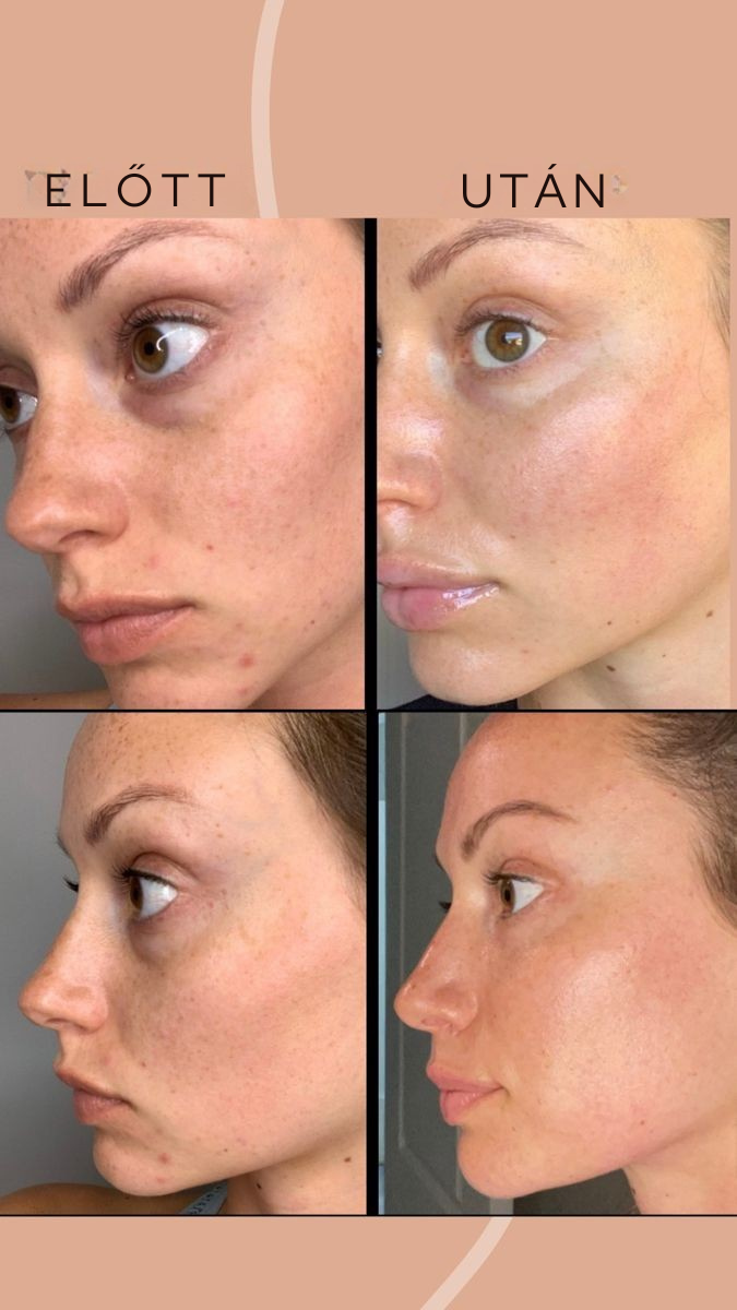 Kiváló minőségű páros füldugók